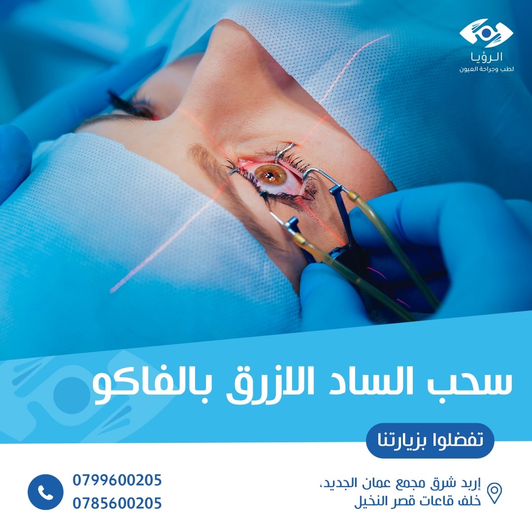 مركز الرؤيا للعيون