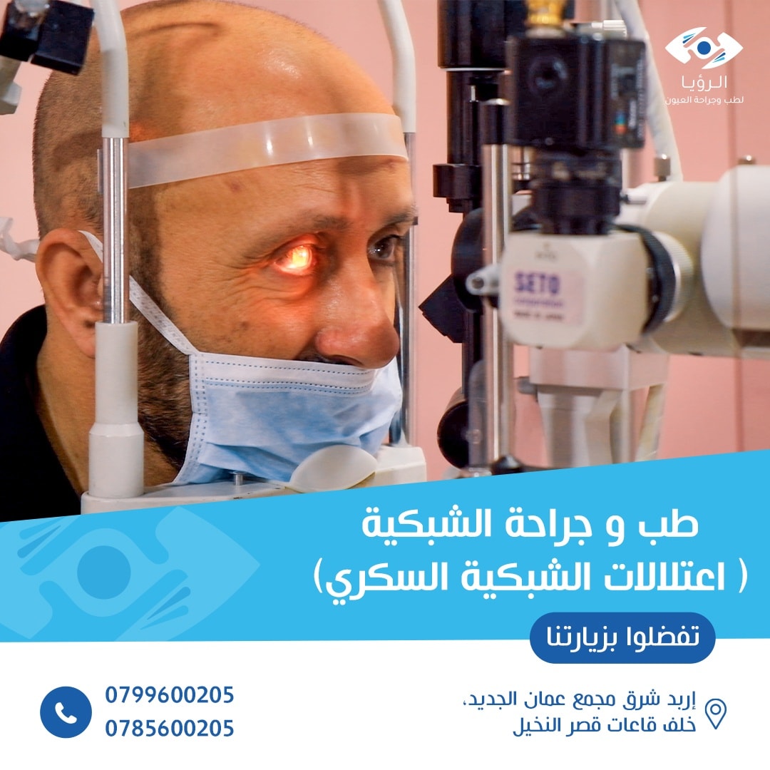 مركز الرؤيا للعيون