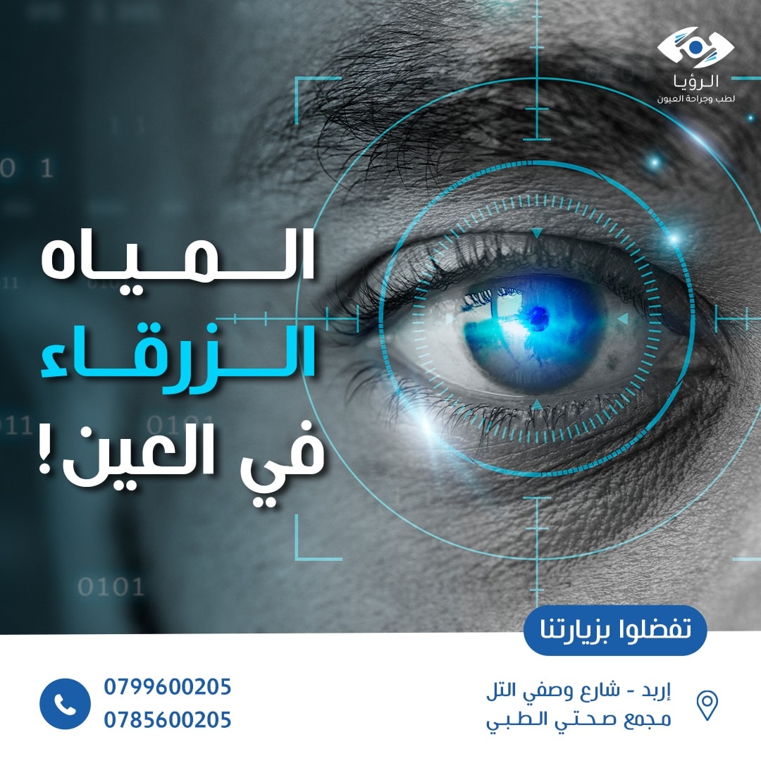 مركز الرؤيا للعيون