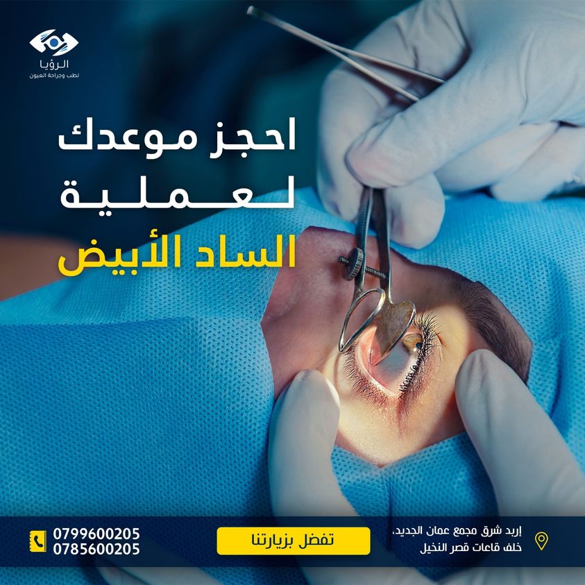 مركز الرؤيا للعيون